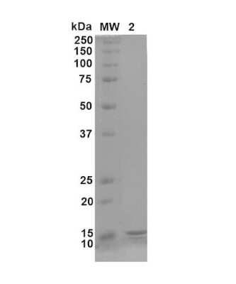 SDS-PAGE: Recombinant Human gamma-Synuclein Active, Monomer Protein [NBP3-14778]